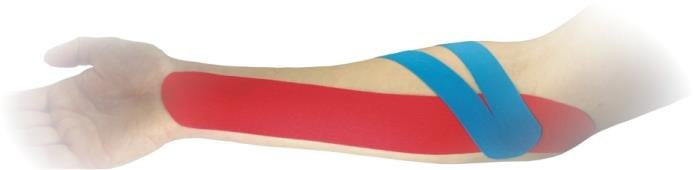 Fink & Walter FIWA®kin – Elastischer Tape-Verband 5cm x 5m, HAUTFARBEN, Pckg. à 1 Stück zur kinesiologischen Therapie / 1 St. (REF 1672202)